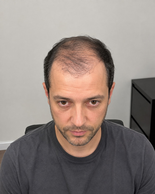 Foto del paziente prima della procedura
