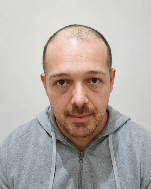 Foto del paziente prima della procedura