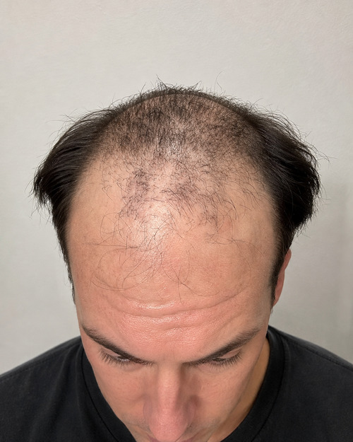 Foto del paziente prima della procedura