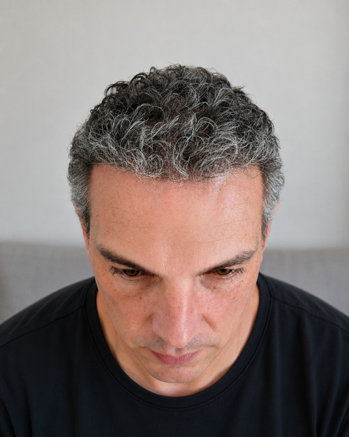 Risultato dopo la procedura
