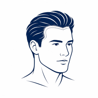 Trapianto di capelli per uomini