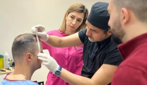 Medico esamina un paziente per un trapianto di capelli, assistito dal suo team.